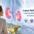 Lupus nefriti tedavisi ve böbrek tutulumunu anlatan, böbrek görseli ve güncel tedavi kılavuzlarını simgeleyen tıbbi illüstrasyon.
