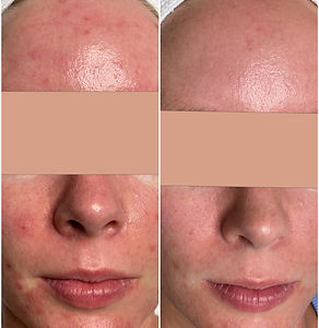 tarapriceestheticsacneclinic_save 3.JPG