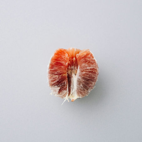 Gallstones & Hormones: Why Women Are More Prone to Gallbladder Issues