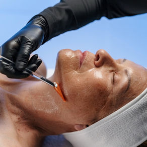 The Fresh-Face Countdown // Circadia’s Guide to Maximizing Skin Peel Season