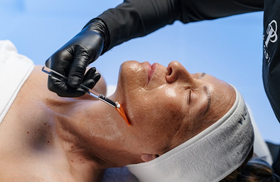 The Fresh-Face Countdown // Circadia’s Guide to Maximizing Skin Peel Season