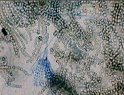 Penicillium sp