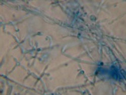 Trichoderma sp