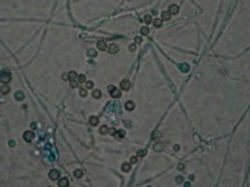 Eladia sacculum