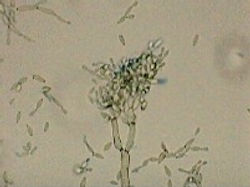 Cladosporium sp