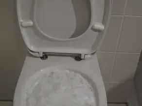 🚽 4 Common Causes of Blocked Toilets in Gravesend, Kent, Essex & South East London – And How to Prevent Them