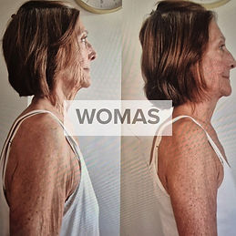 Professional Kinesiolifting session – therapist performing facial and body alignment massage