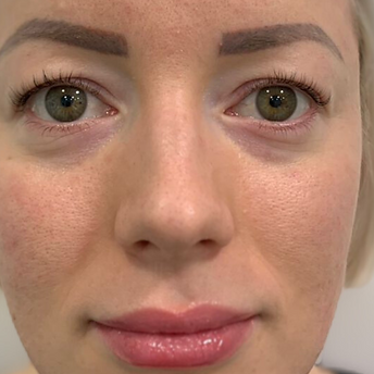 Zaneta - 2. - před.png