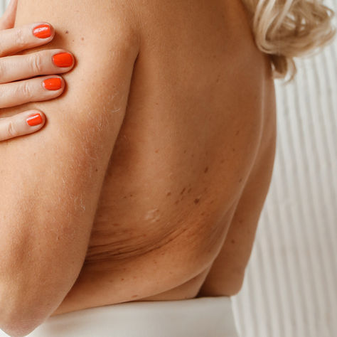 vyšetření znamének Brno