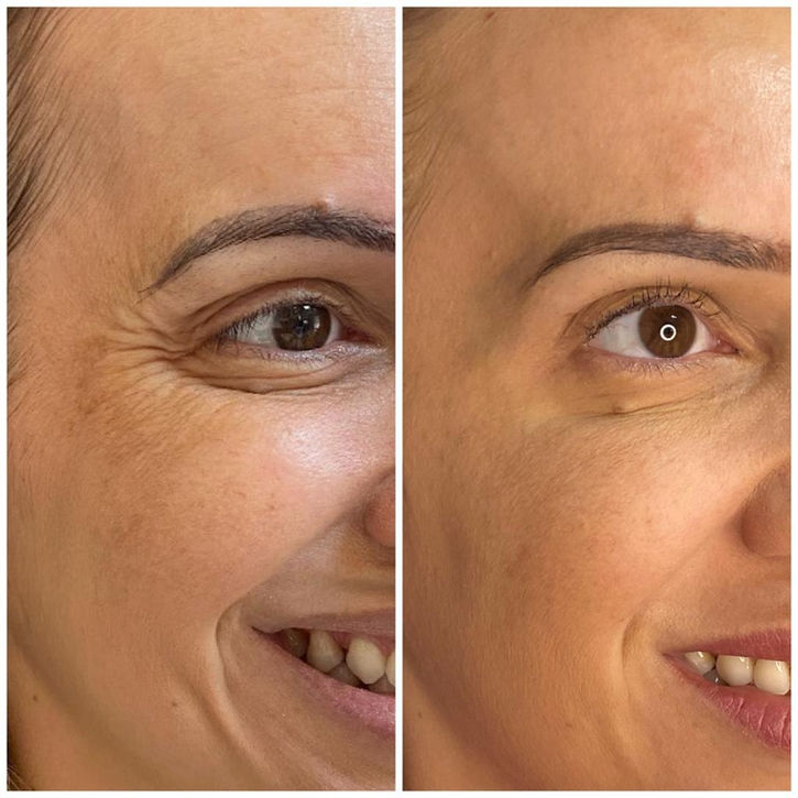 Foto de cliente mostrando resultado de procedimento estético