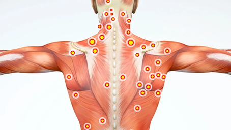Myofascial Pain