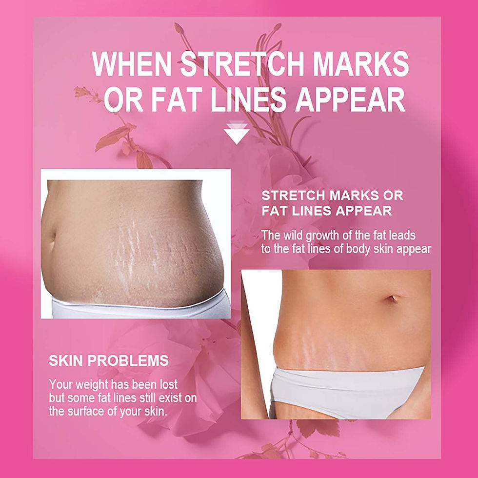 Thumbnail: AILKE Organic Stretch Mark Cream for Pregnancy, Maternity Scar, Fat Lines Remov