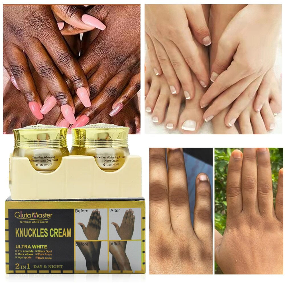 Gluta Master Knuckles Brightening Cream for Hand Whitening Moisturizing to Remo