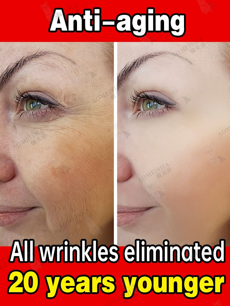Thumbnail: Remove All Facial Wrinkles Fine Lines Dark Circles Forehead Wrinkles Neck Wrink