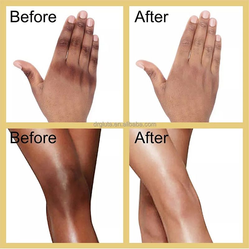 Miniatura: Gluta Master Removing stains Body Lotion Whitening Brightening Skin Knuckles Kn