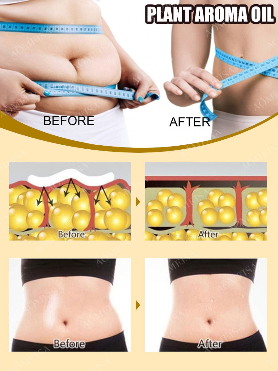 Thumbnail: Fat Burning Slimming Oil Lose Weight Fast Belly Losing Weight Tummy Fat Lose Sl