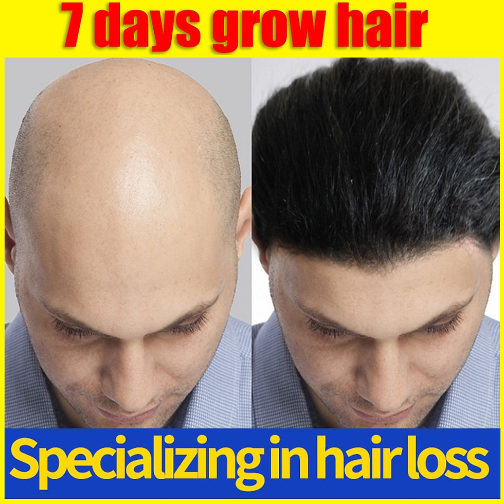 Thumbnail: Fast Hair Growth Hair Follicle Treatment Hair Growth Seborrheic Alopecia Hairli