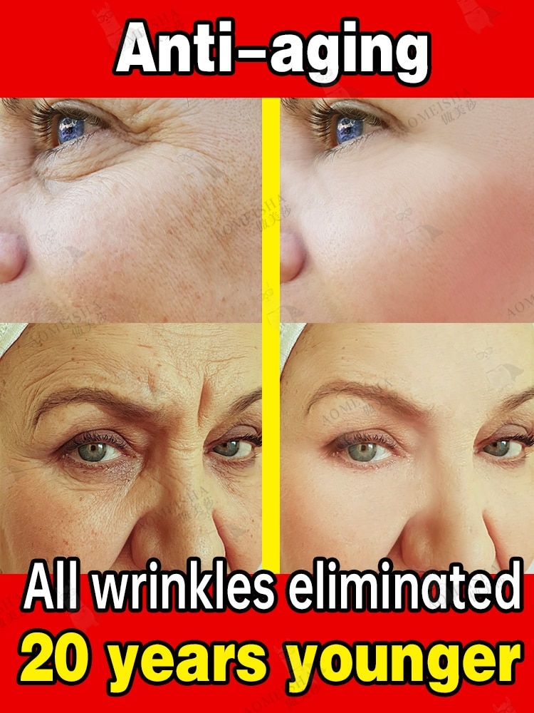 Thumbnail: Remove All Facial Wrinkles Fine Lines Dark Circles Forehead Wrinkles Neck Wrink