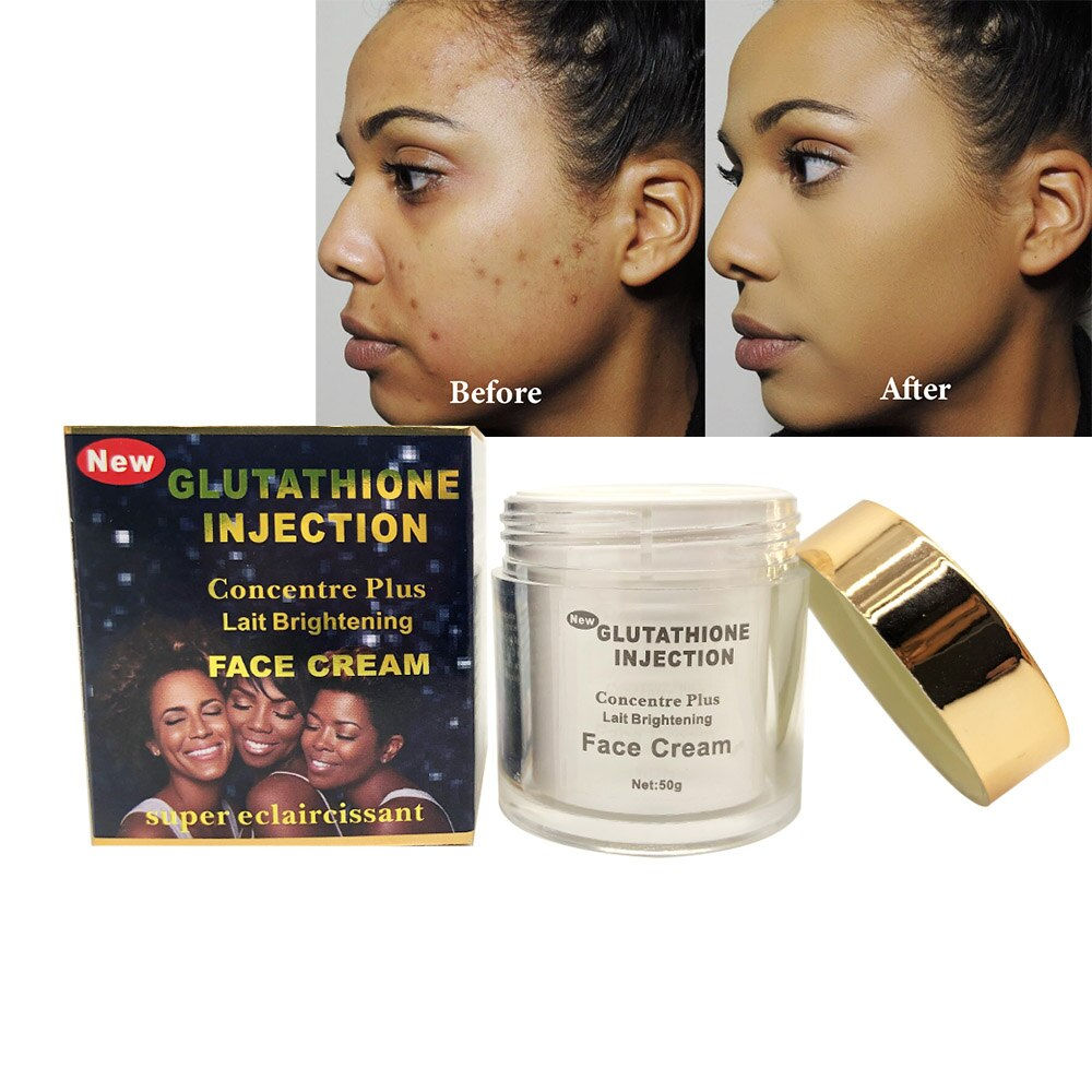 Whitening Moisturizer Face Cream 50g Remove Melanin Spot Glutathion Skin Whiten