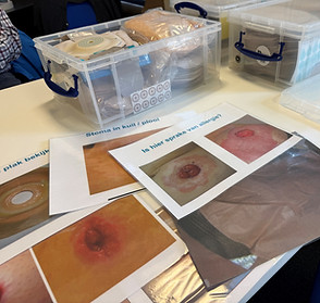 Foto stoma.jpg