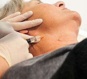 bio stimulating injections, bio remodelling injectables, profhilo, profhilo melbourne, profhilo injectables, profhilo treatment near me, best place for profhilo