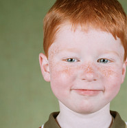 Freckled Kid