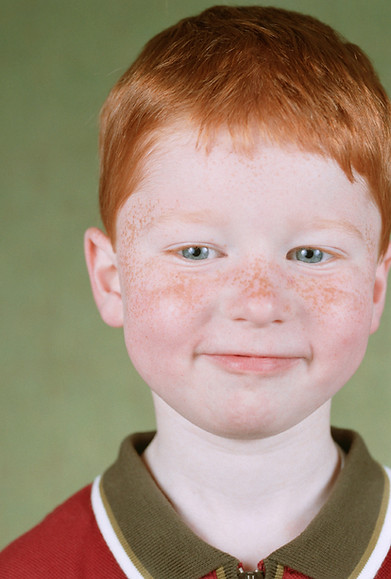 Freckled Kid