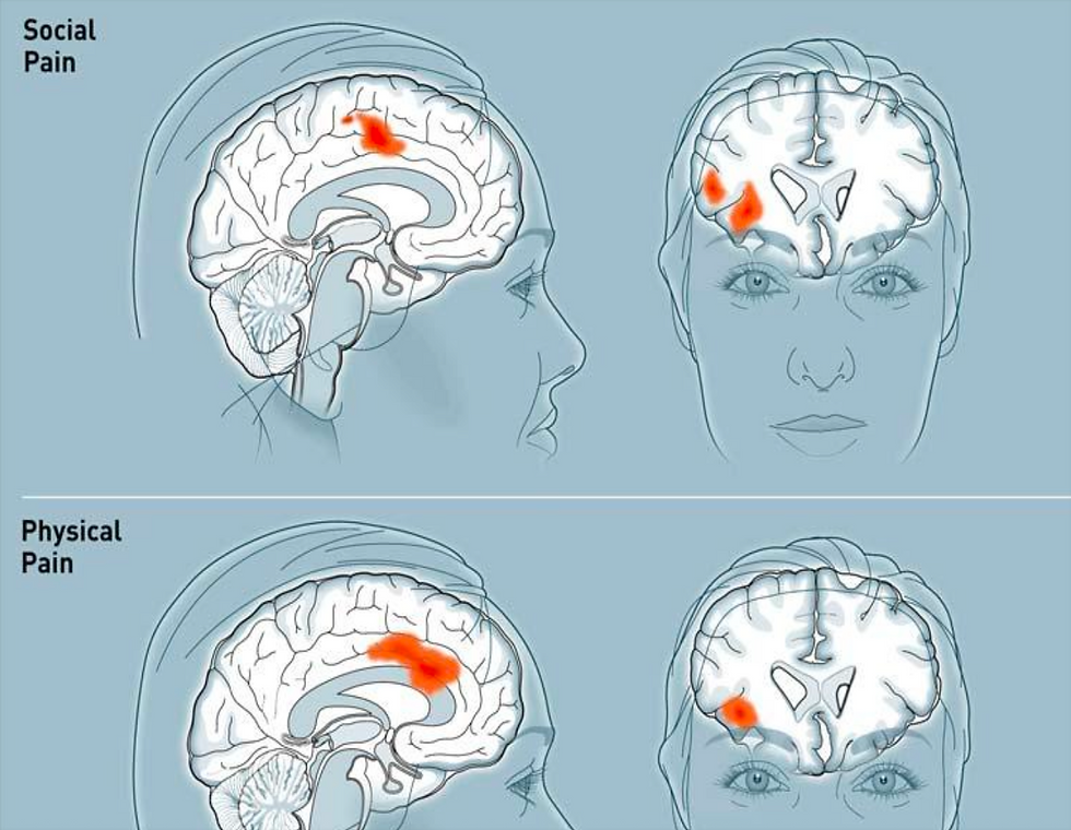 Sociale stress bij autisme