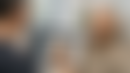 Will AI replace the hair transplant surgeon? See how AI hair transplant planning improves precision — and what still depends entirely on the surgeon.