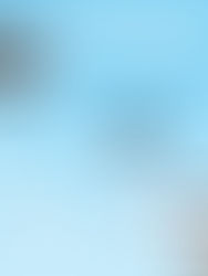 Already Using leviacam? Here Is How to Upgrade to 3D Hair Transplant Planning