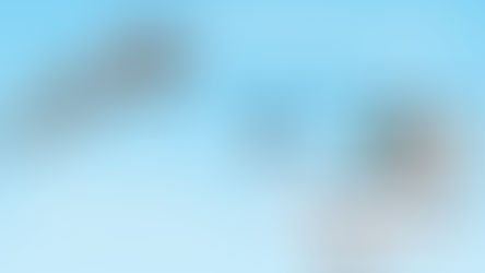 Already Using leviacam? Here Is How to Upgrade to 3D Hair Transplant Planning