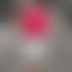 2024/06/18 李水伯-我終於可以穿鞋子了!