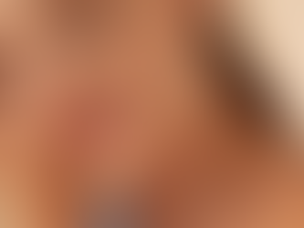 Ácido Hialurónico para aumento de Labios: guía completa de Clínica Perova en Valencia