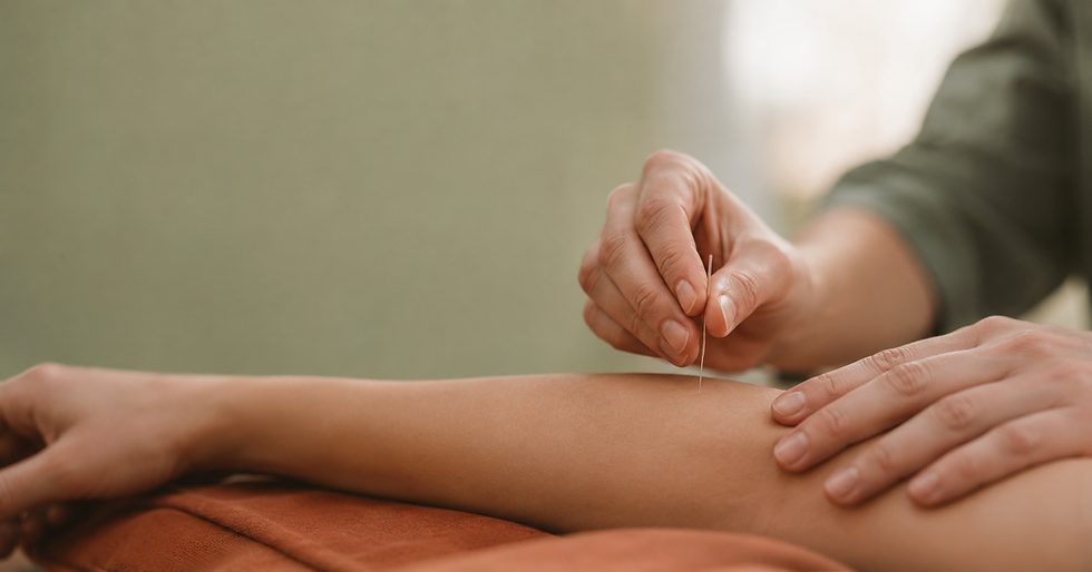 Fines aiguilles d'acupuncture délicatement posées lors d'une séance, dans un cabinet lumineux