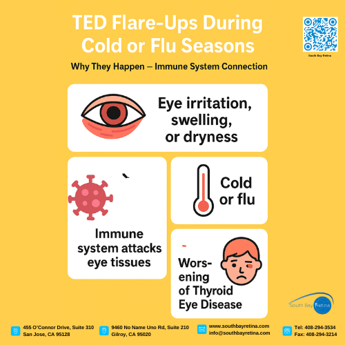 South Bay Retina | Thyroid Eye Disease flare-ups can occur during cold or flu seasons due to immune system reactions, leading to eye irritation and worsening symptoms.
