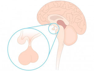 Source: “What Caused My Pituitary Gland Damage?” — The Endocrine Center, Houston, TX. © 2025 The Endocrine Center. Read the original article here.