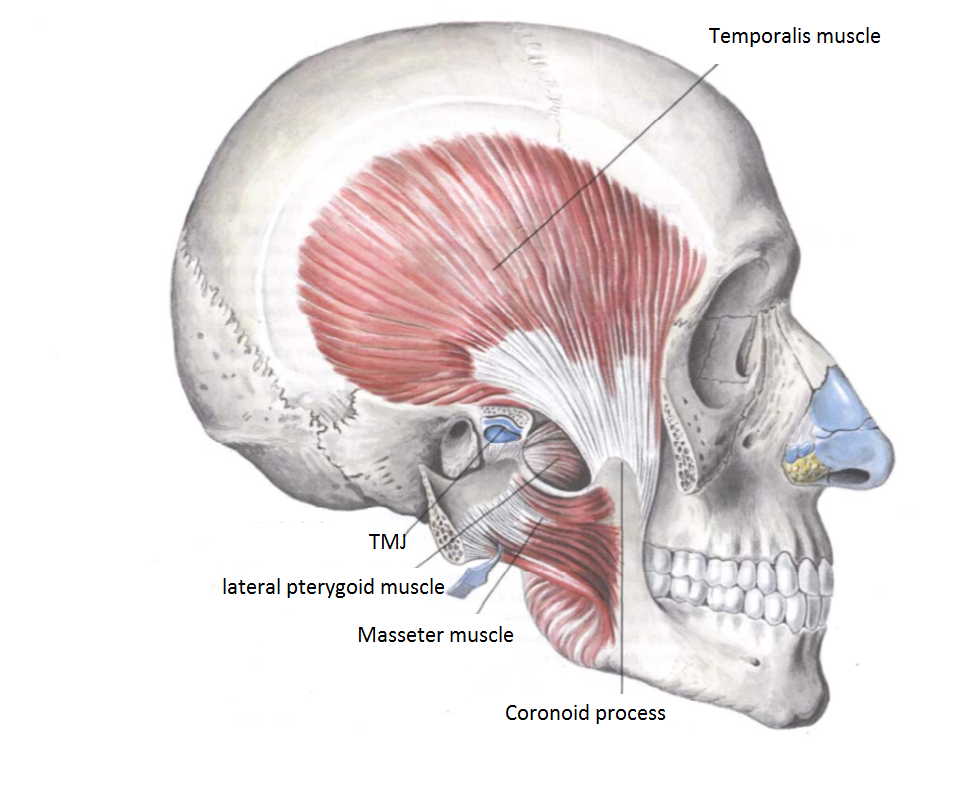 What Does Masseter Reduction Botox Involve?