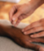 Chinese acupuncture San Francisco