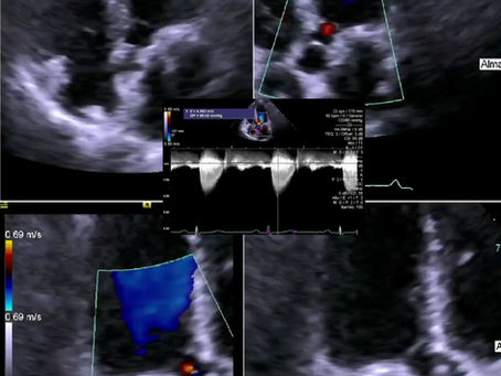 Respuesta a la trivia de la semana
