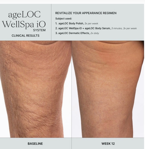 ageLOC WellSpa iO Essential System | Dailyskincare.co.uk