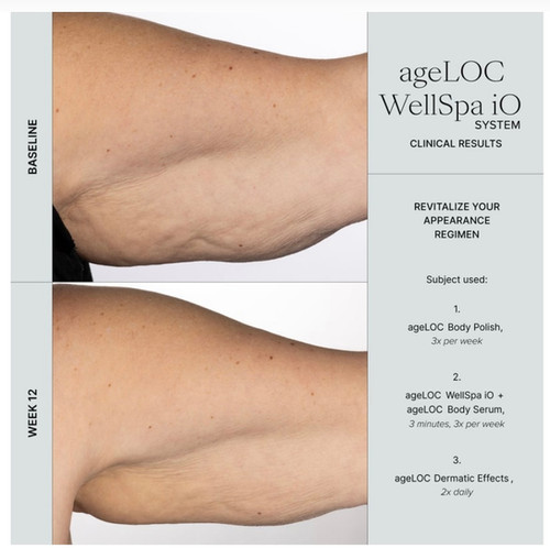 ageLOC WellSpa iO Essential System | Dailyskincare.co.uk