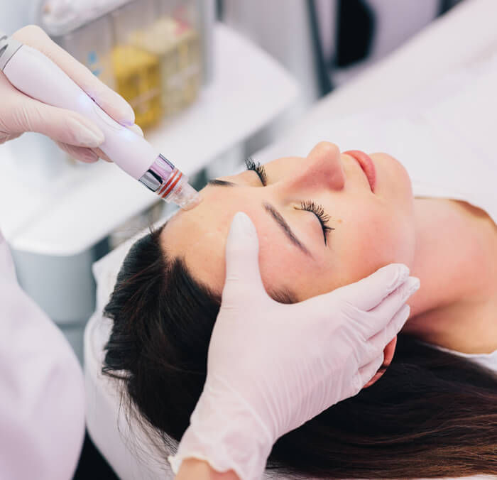 Ultra Wellness Medical - Hydrafacial - O'Fallon, MO