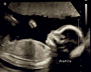 Scan_20191209 (2) resized.png
