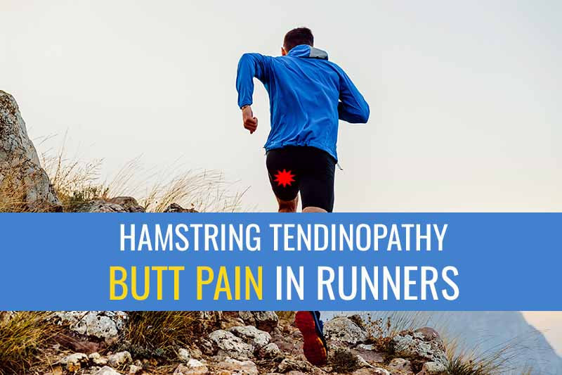Proximal hamstring tendinopathy a common cause of butt pain in runners. Sports Injury Physio