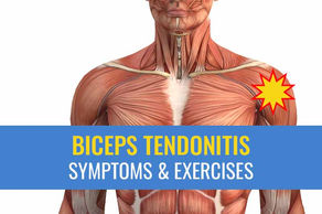 Biceps tendonitis treatment: Causes, symptoms, exercises, and recovery times