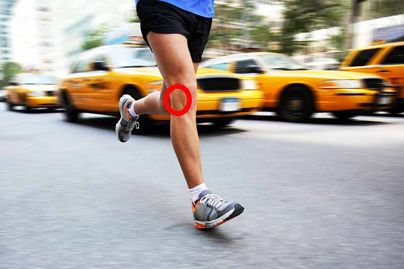 Iliotibial band syndrome causes pain on the outside of the knee.