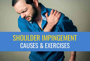 Shoulder impingement – A common cause of shoulder pain