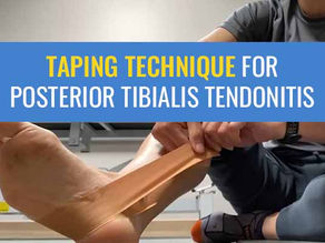 Taping for posterior tibial tendonitis