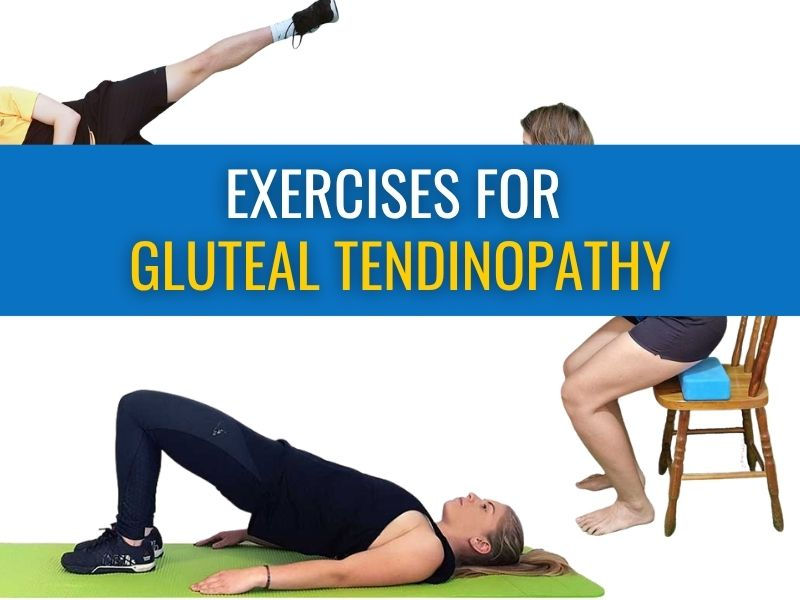 Exercises for gluteal tendinopathy – What works, how to progress, and what to avoid