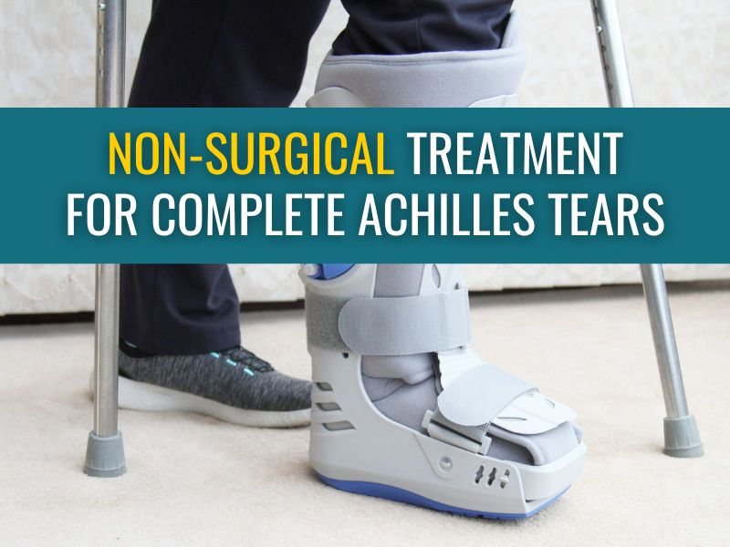 Non-surgical protocol for complete Achilles tendon ruptures.
